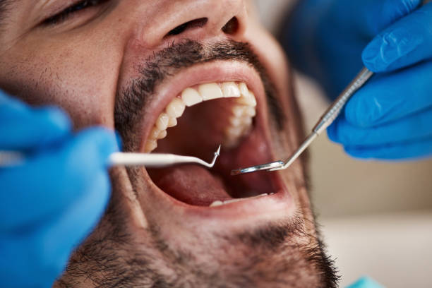 Best Walk-In Emergency Dentist in Central, TN