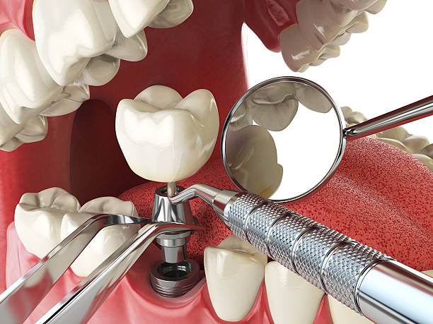 Best Weekend Emergency Dentist in Central, TN